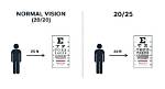 20/13 Vision