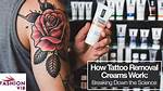 4 Best Tattoo Removal Creams and How It Works in 2024