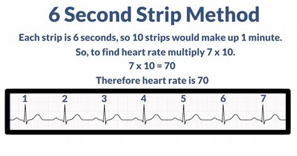 6 Second Ecg
