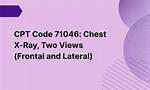 71046 Cpt Code