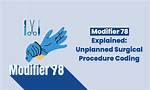 78 Modifier