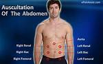 Abdominal Bruit