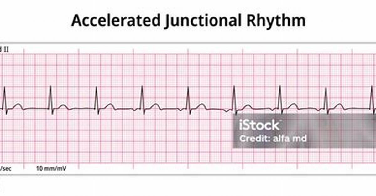 Accelerated Junctional