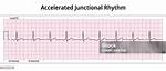 Accelerated Junctional