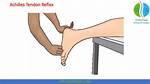 Achilles Reflex