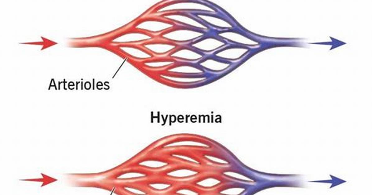 Active Hyperemia