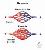 Active Hyperemia