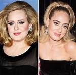 Adele Plastic Surgery: Her New Look Sparks Plastic Surgery Speculation!