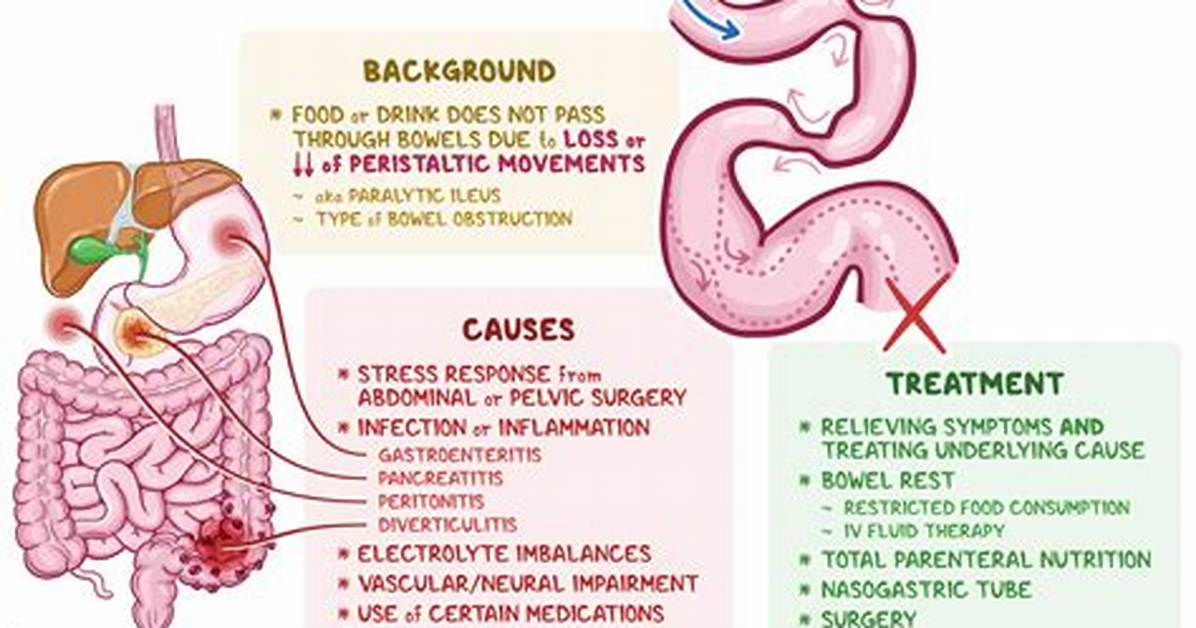 Adynamic Ileus