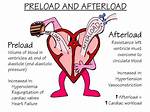 Afterload vs Preload