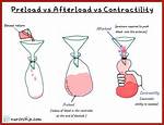 Afterload