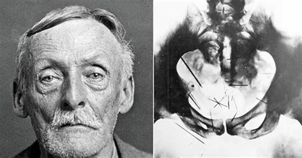 Albert Fish