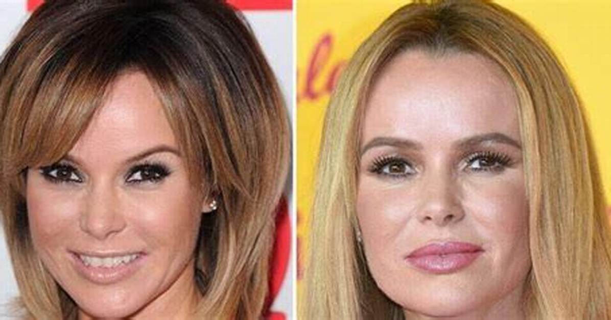 Amanda Holden Plastic Surgery: from Natural to Enhanced