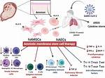 Amniotic Stem Cell Therapy