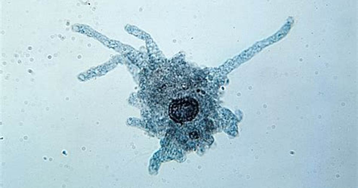 Amoeba Under Microscope