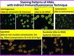 Ana Pattern