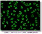 Ana Speckled Pattern