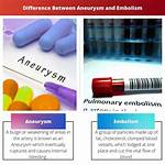 Aneurysm vs Embolism