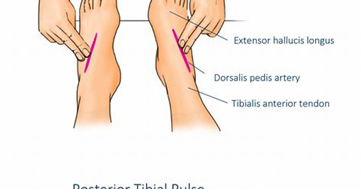 Ankle Pulse