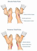 Ankle Pulse