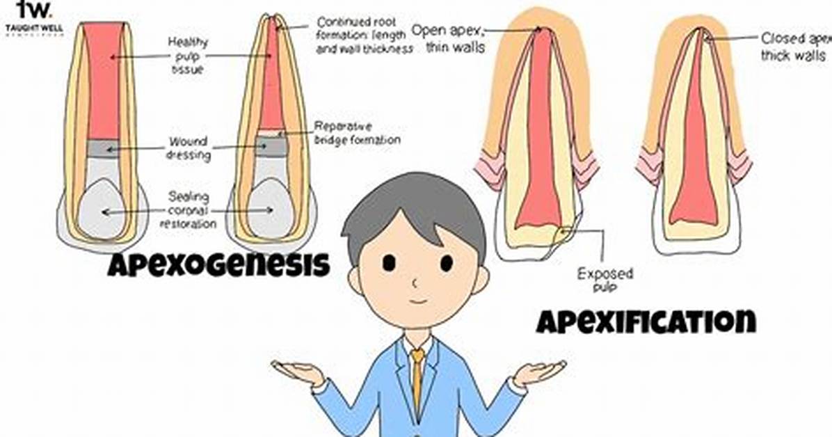 Apexogenesis