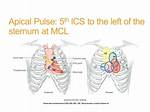 Apical Impulse
