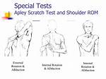 Apley’s Scratch Test