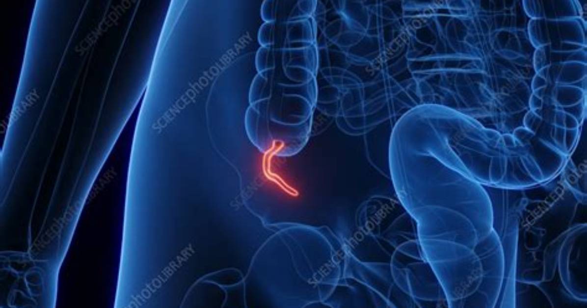 Appendix Location Female