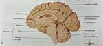 Arbor Vitae Brain