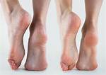 Arch Disorders
