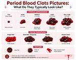 Are Clumpy Periods Normal?