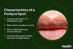 Are Fordyce Spots Spreadable?