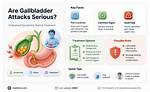 Are Gallbladder Attacks Serious?