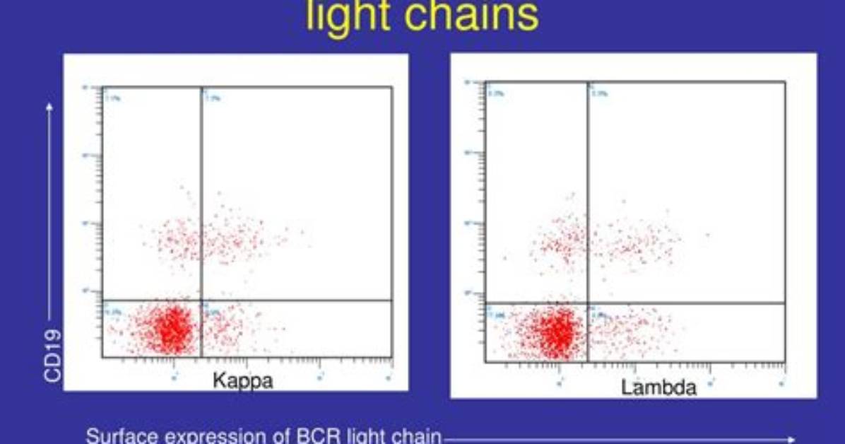 Are Polyclonal B Cells Normal?