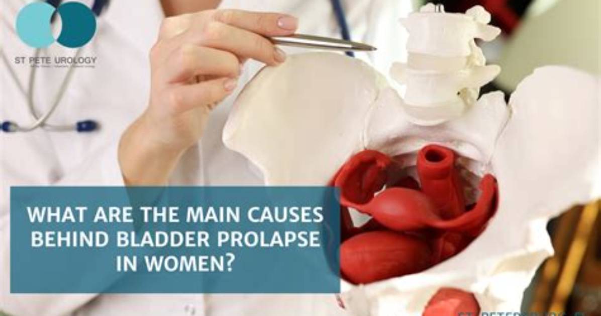 Are Prolapsed Bladder Common?
