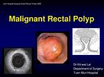 Are Rectal Polyps Common?