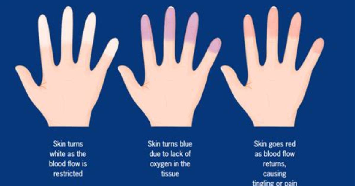 Are Red Hands Normal?