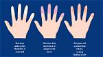 Are Red Hands Normal?