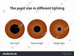 Are Small Pupils Normal?