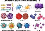 Are Some Std Permanent