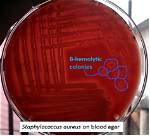 Are Staphylococcus Beta Hemolytic?