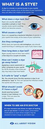 Are Styes Contagious? - All About Vision
