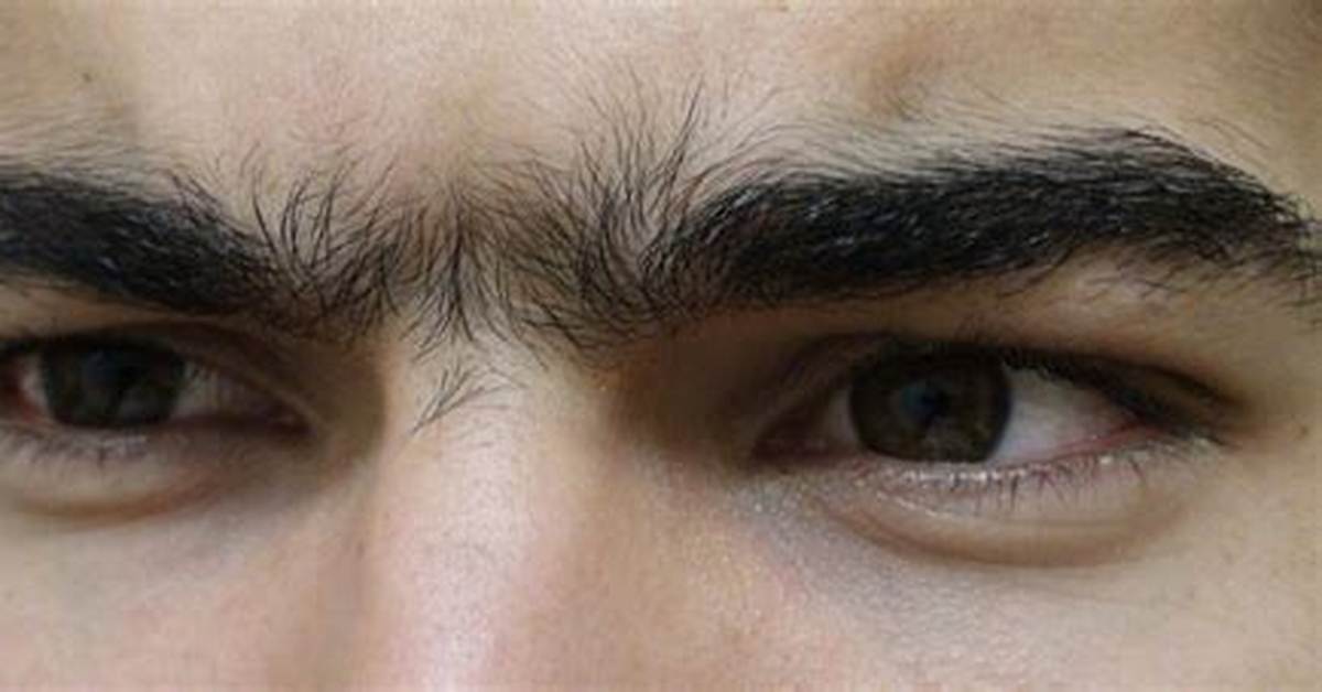 Are Unibrows Normal?