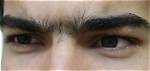 Are Unibrows Normal?