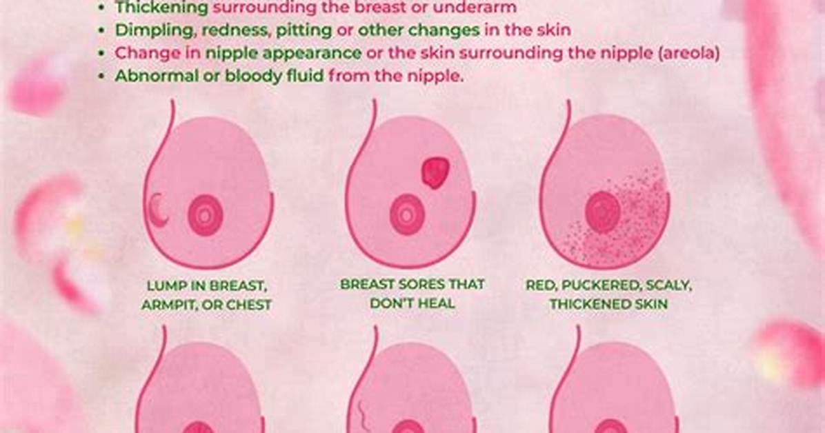 Areola Changes