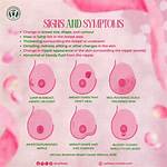 Areola Changes