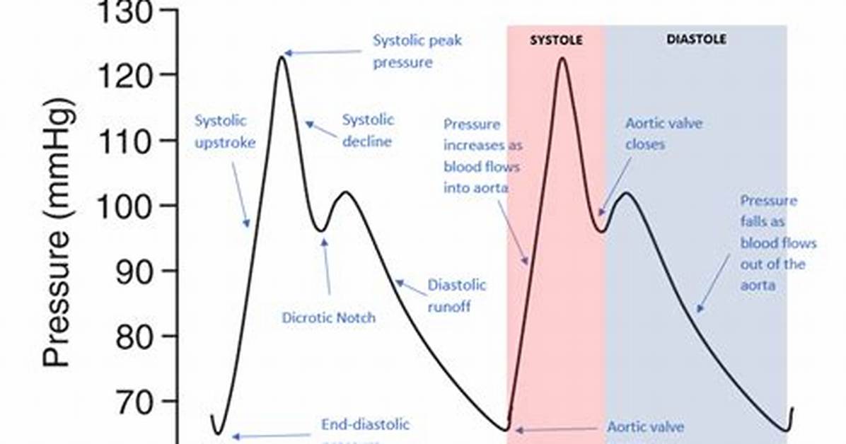 Arterial Waveform
