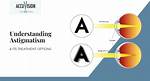 Astigmatism: Astigmatism Faqs