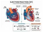 At Rest Ejection Fraction?