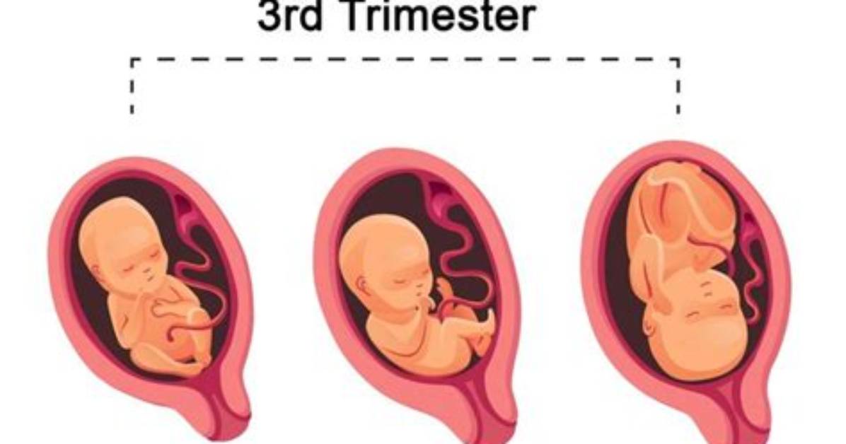 At the Third Trimester?